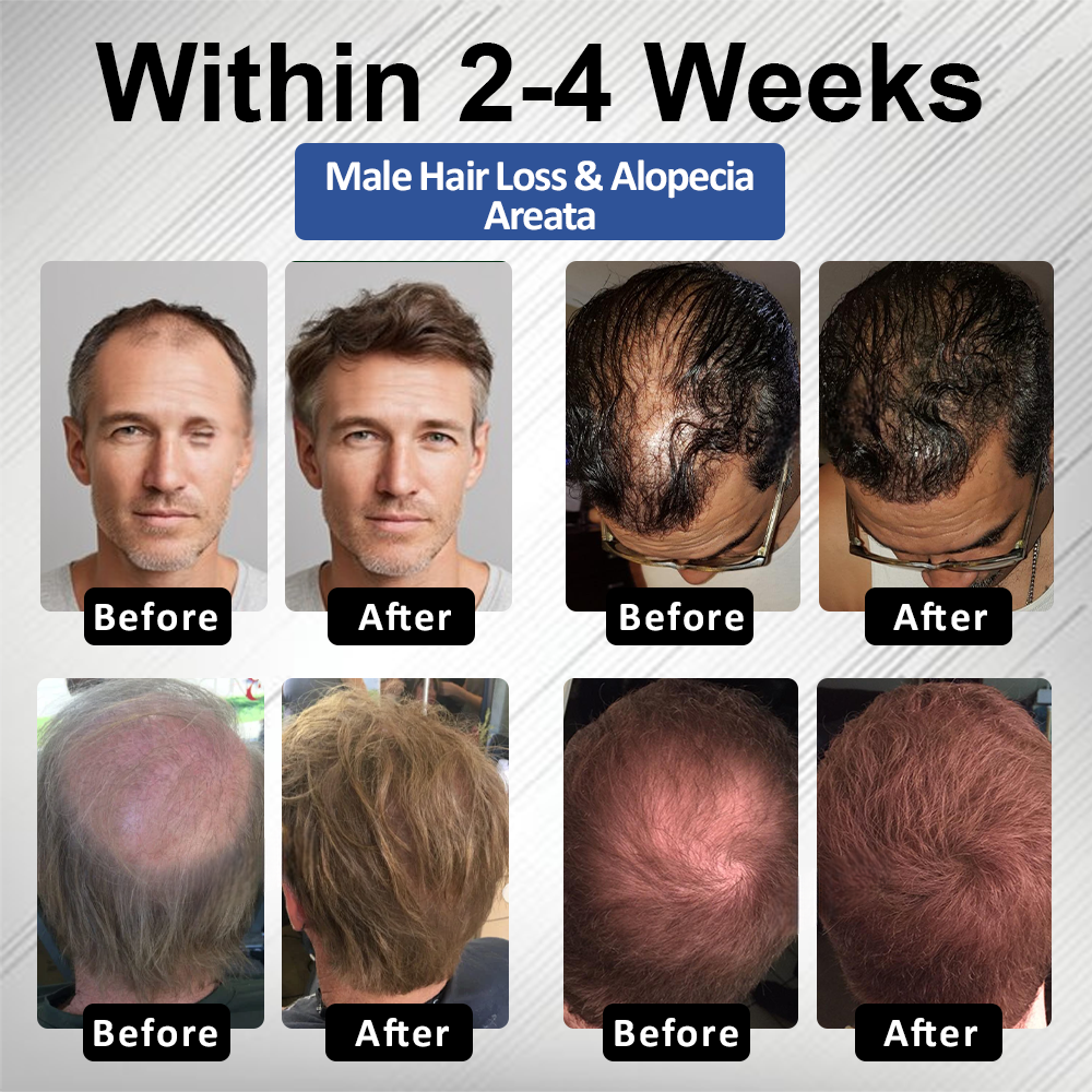 🔥FDA-Reviewed. Visible in 7 Days. Guaranteed-DarkFairy® PP405 FolliGen Re-Awaken Hair Spray