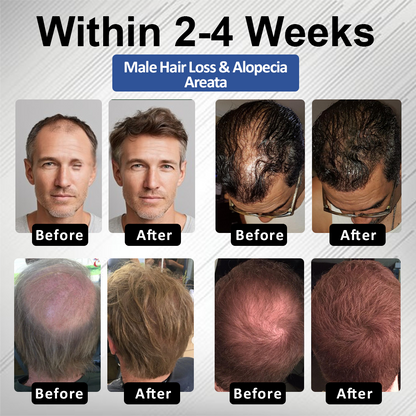 🔥FDA-Reviewed. Visible in 7 Days. Guaranteed-DarkFairy® PP405 FolliGen Re-Awaken Hair Spray