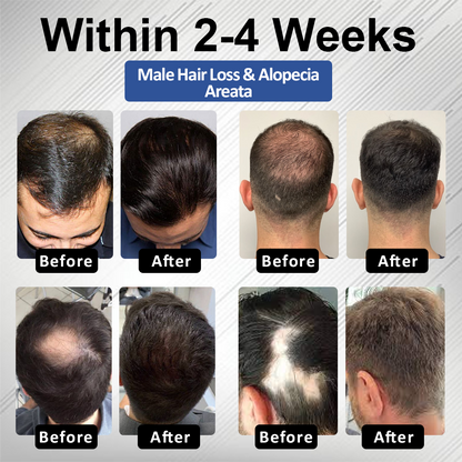 🔥FDA-Reviewed. Visible in 7 Days. Guaranteed-DarkFairy® PP405 FolliGen Re-Awaken Hair Spray