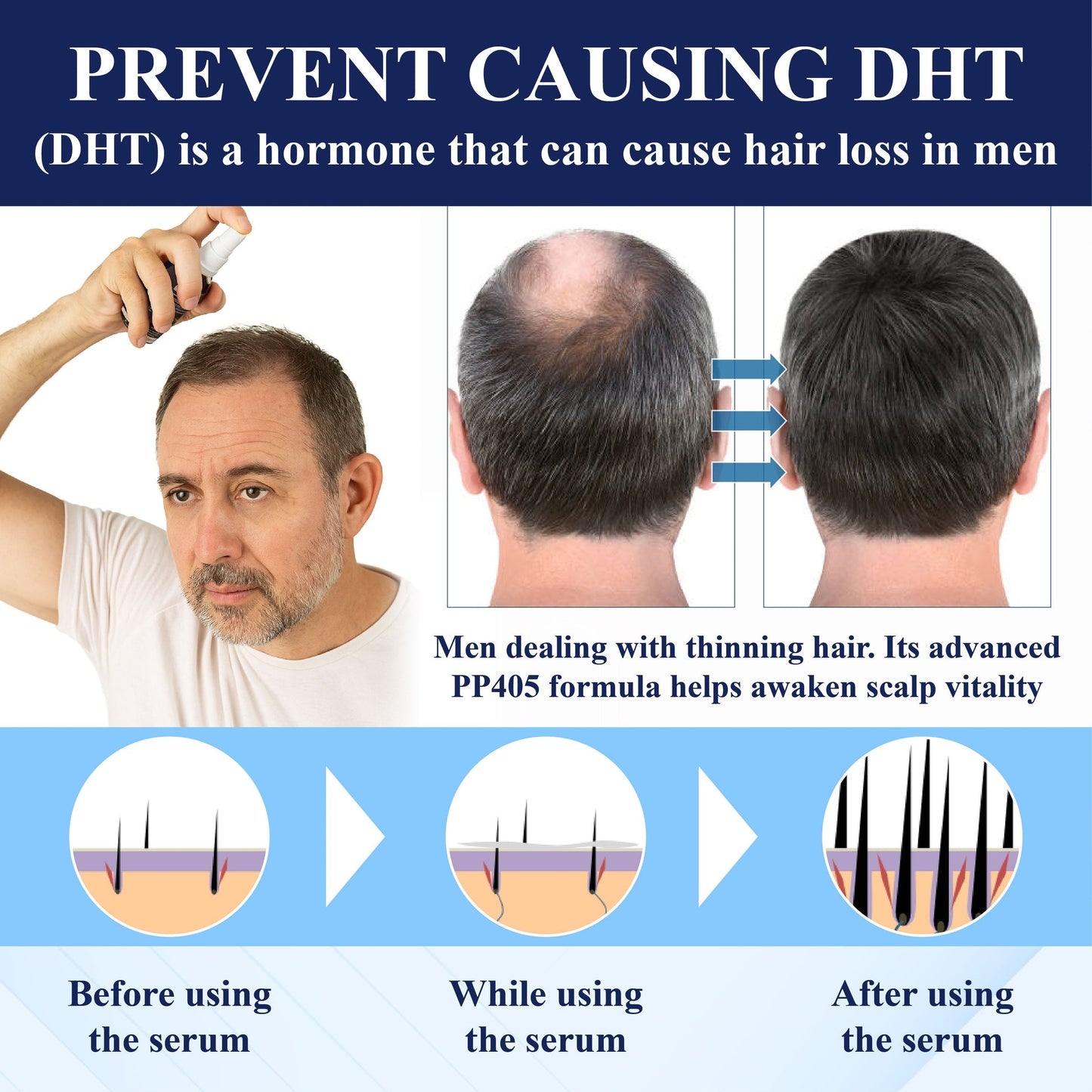 🔥FDA-Reviewed. Visible in 7 Days. Guaranteed-DarkFairy® PP405 FolliGen Re-Awaken Hair Spray