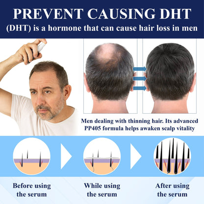 🔥FDA-Reviewed. Visible in 7 Days. Guaranteed-DarkFairy® PP405 FolliGen Re-Awaken Hair Spray