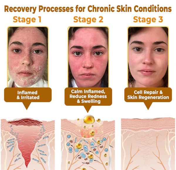 🔥 FDA-Reviewed. Visible in 7 Days. Guaranteed-DarkFairy® Anti-wrinkle andanti-aging Skin Treatment Cream